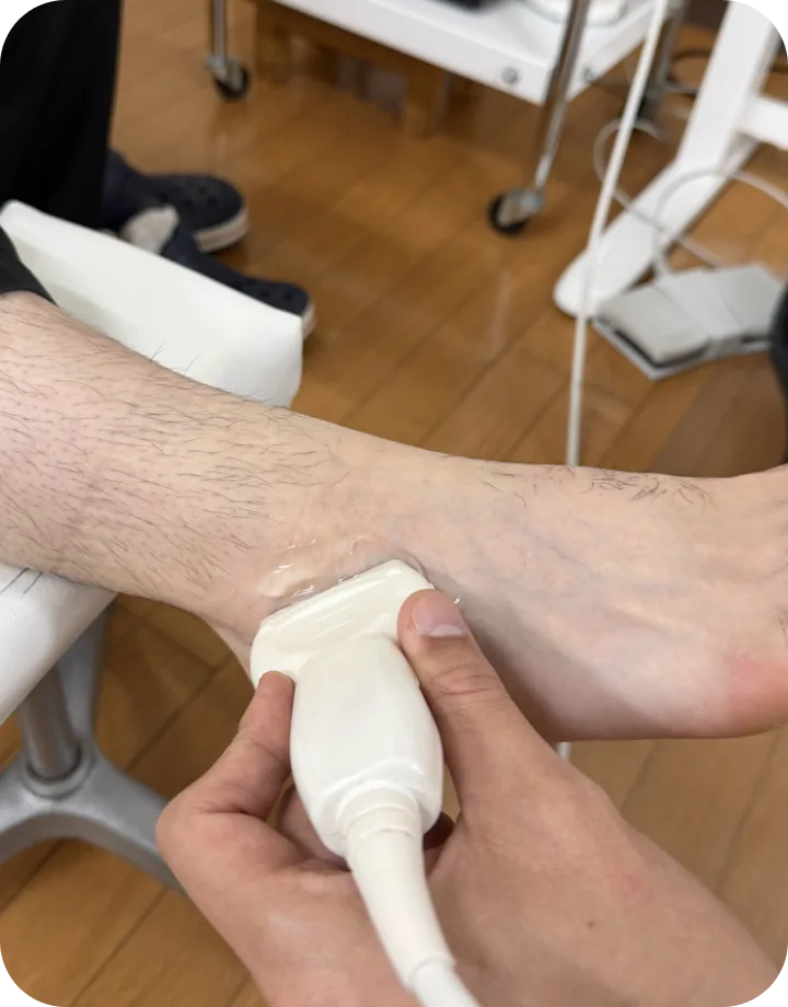 足首の捻挫をエコーで観察している様子